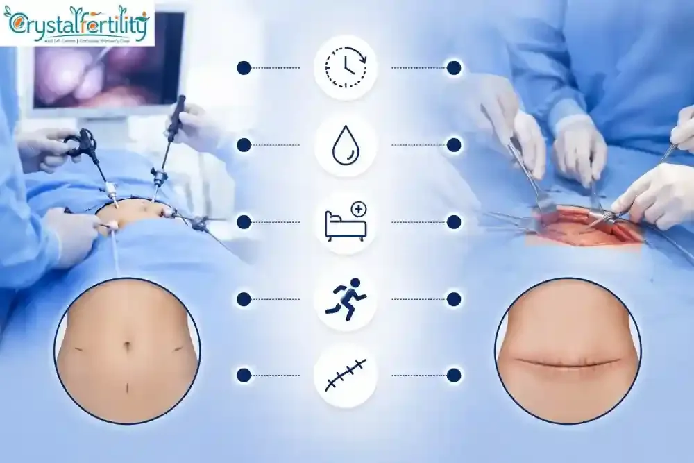 Benefits of Laparoscopic Surgery Over Traditional Open Surgery